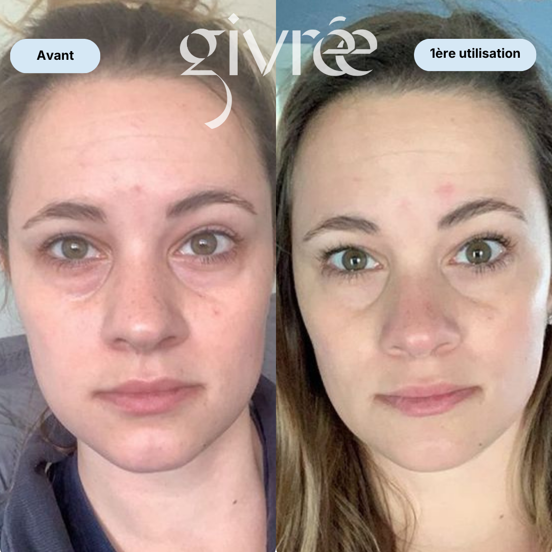 Givrée Cube - Une peau sans défauts