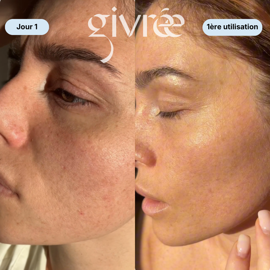 Givrée Cube - Une peau sans défauts