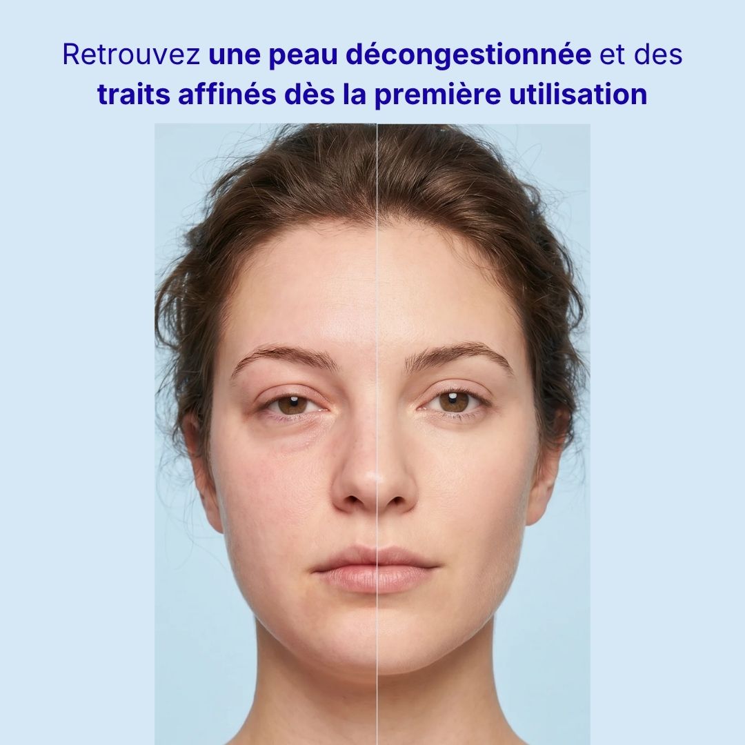 Givrée Cube - décongestion visage