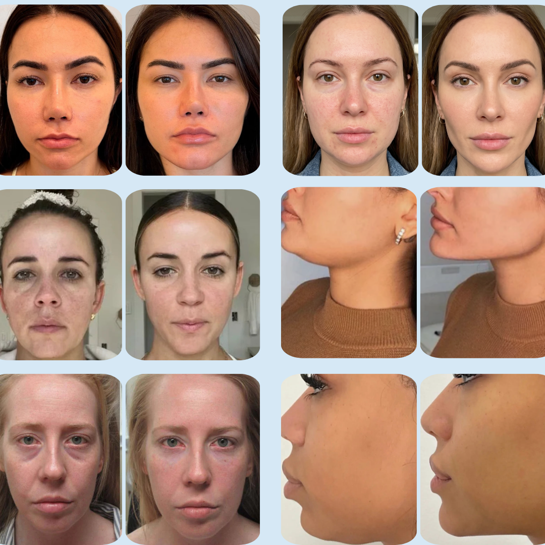 Rituel décongestion visage complet